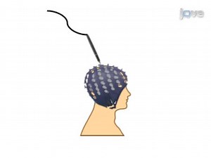 Serie: Untersuchung der Eigenschaften des episodischen Gedächtnisses anhand ereigniskorrelierter Potentiale bei Patienten mit Alzheimer-Krankheit