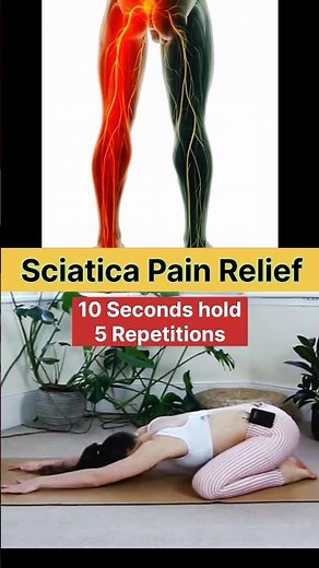 "Instant Sciatica Pain Relief | Simple and Effective Exercise."