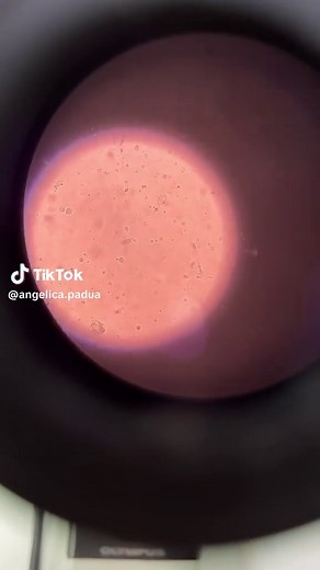 Exploring Giardia Lamblia Under the Microscope