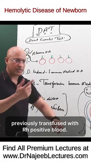 4.1K views · 171 reactions | Hemolytic Disease of Newborn This Reel...