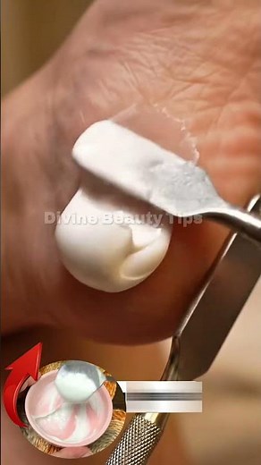 The strongest homemade recipe to deeply moisturize dry feet and heal cracked heels fast! 🦶