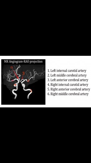 #MRI #MRA #Artery #anatomy | CT Scan and MRI study