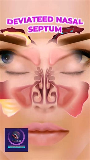 The Nasal Septum: Why It Matters for Your Breathing #3danimation #medical #foryou | Medical Animation Media