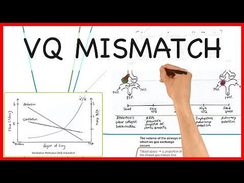 VENTILATION PERFUSION (V/Q) MISMATCH- PHYSIOLOGY SERIES