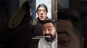 Tragic story of "ugliest woman in the world"