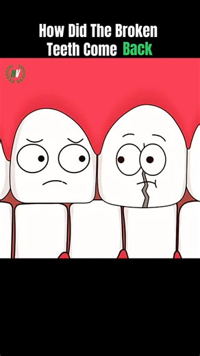 Health.Dailywellness.Selfcarespot on Instagram: "How Did The Broken Teeth Come Back? ... Broken teeth don’t grow back naturally, because enamel can’t regenerate. But dentists can restore them using treatments like: Bonding – for small chips Crowns – for larger breaks Veneers – for cosmetic repair Root canal + crown – if the nerve is exposed Implants – if the tooth can’t be saved Regrowing teeth isn’t possible yet, but research is ongoing. ... Credit...@FrameFable-xin8 ... #HealthyHabits #Wellnes