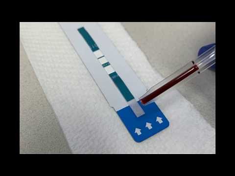 What to expect in a rapid HIV test. | Dr George Forgan-Smith HIV testing Melbourne