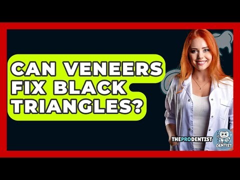Can Veneers Fix Black Triangles? - The Pro Dentist