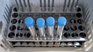 Coronavirus Tests Offer Competing Benefits: Speed vs. Accuracy