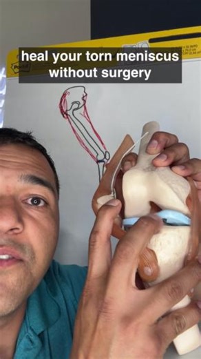 111K views · 925 reactions | Let me explain to you what the root problem that leads to a torn meniscus is and how to treat it. #meniscus #kneepain #tornmeniscus #kneepainhelp #meniscustear | El Paso Manual Physical Therapy | Facebook