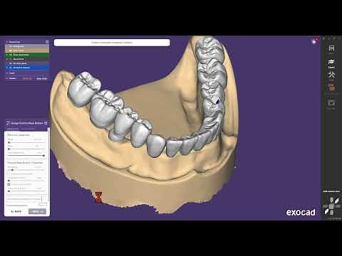 Using Novaloc & MedentiLOC Library for Abutment Level Workflow in Exocad DentalCAD - Tutorial 2024