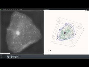 Human Cheek Epithelial Cells with bacteria