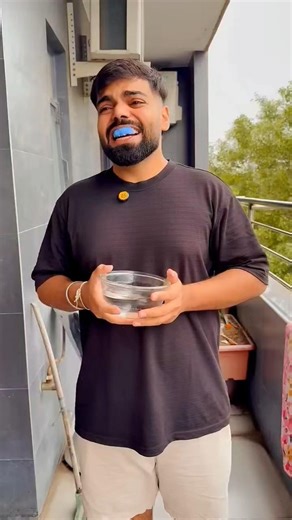 What is all this about Gourav's teeth? #shorts #short #trend