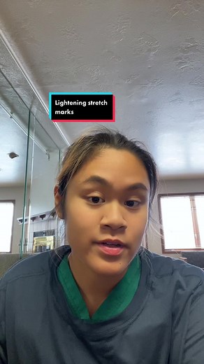 Tips for Understanding and Removing Stretch Marks on Stomach