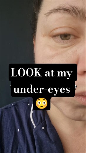 LOOK at my under-eyes 😳#skincare #skincareroutine #skincaretips #trending #kbeauty #fyp #fy #skin