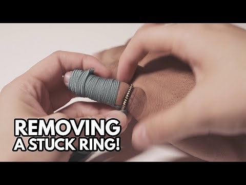 HOW TO REMOVE A RING STUCK ON A FINGER!