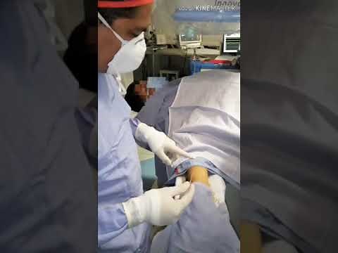 Como se realiza un caterismo cardiaco por el brazo.