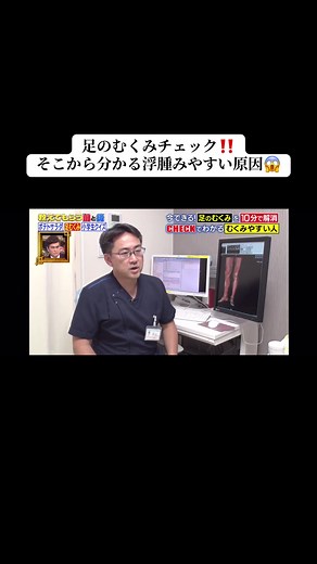 足のむくみ解消方法とケア