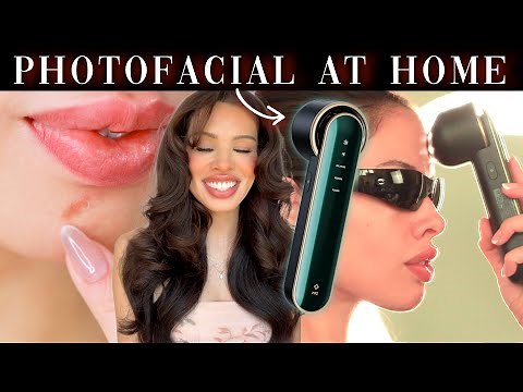 This NEW Technology REMOVES Hyperpigmentation, Dark Spots, and Sun Damage! | JOVS Blacken Pro DPL