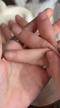 #Hot topic #Aesthetic silicone fingers #Prosthetic finger