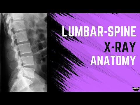 Lumbar Spine X-ray Anatomy
