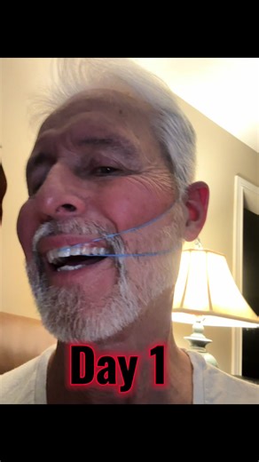 jamiekenworthy16 (@jamiekenworthy16)’s video of boys with braces