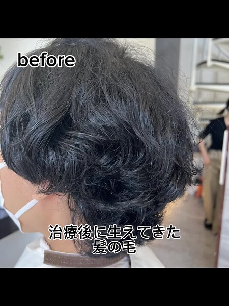 抗がん剤治療後のくせ毛改善法