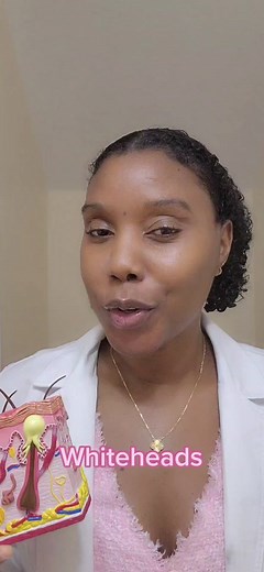 Understanding Whiteheads: Causes and Differences from Blackheads