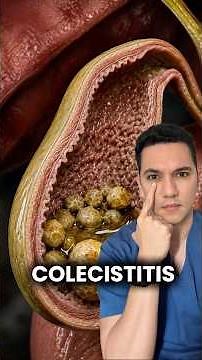 Gallstones and inflammation: what you should know. #healthtips #healthandwellness