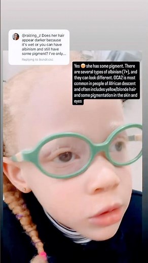 Some #albinism questions answered