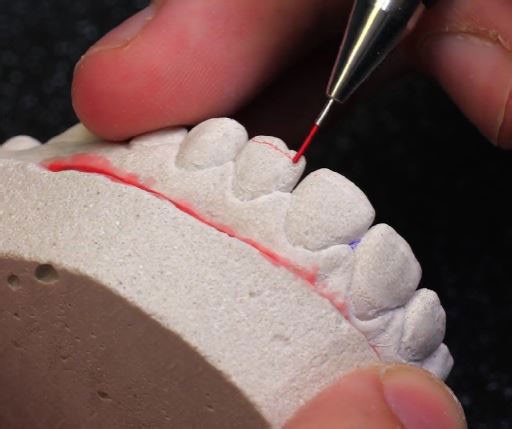 Crafting custom bling: Create your own grillz