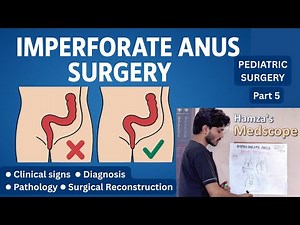 Imperforate Anus | Pediatric Surgery (Pathology, Reconstruction ) #pediatricsurgery #peadiatrc