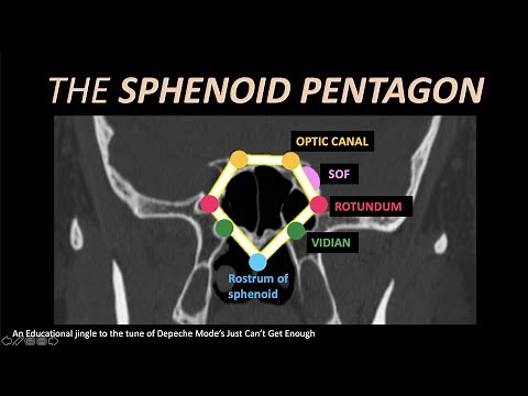 A Jingle for Foramen Rotundum, Vidian and SOF (CT)