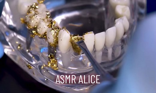 【ASMR🦷】音フェチな歯科ロールプレイ / 抜歯, 歯石除去 #asmr #asmrtiktoks #音フェチ #fyp #dental #dentalist #歯医者 #tooth