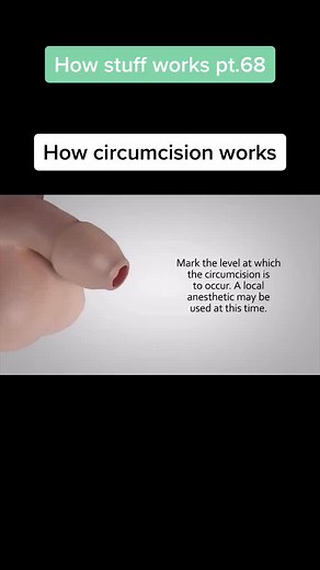 Follow for more⚠️ #educational #surgery #doritosflatlife #howthingswork #ourhouse2021 #interesting #facts #circumcision