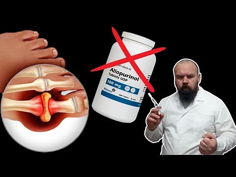 Nebenwirkungen des Arzneimittels Allopurinol. Das müssen Sie wissen!