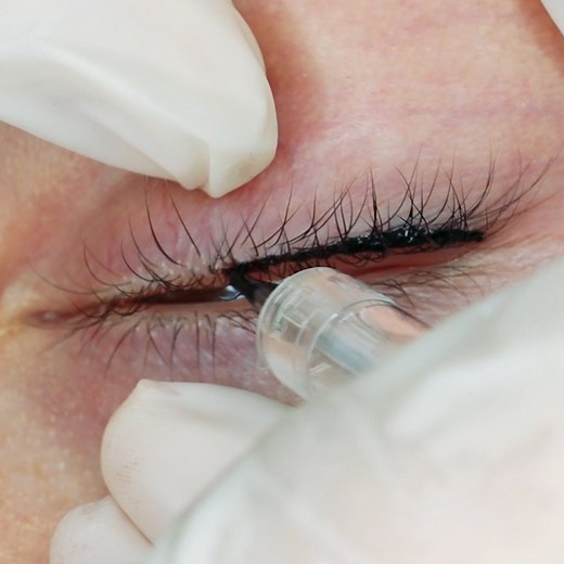 Permanent eyeliner Tattoo - Everyone is doing it. | MetDaan