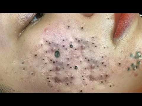 𝑺𝒐𝒐𝒕𝒉𝒊𝒏𝒈 𝑭𝒂𝒄𝒊𝒂𝒍 𝑻𝒓𝒆𝒂𝒕𝒎𝒆𝒏𝒕 𝑭𝒐𝒓 𝑺𝒕𝒓𝒆𝒔𝒔 𝑹𝒆𝒍𝒊𝒆𝒇 𝒂𝒕 𝑳𝒖𝒙𝒖𝒓𝒚 𝑺𝒑𝒂 𝑨𝒄𝒉𝒊𝒆𝒗𝒆 𝑰𝒏𝒏𝒆𝒓 𝑷𝒆𝒂𝒄𝒆 #2632121