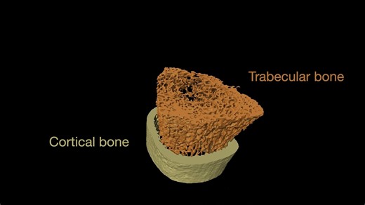 结合 microCT 和 Amira 软件区分骨小梁和皮质骨