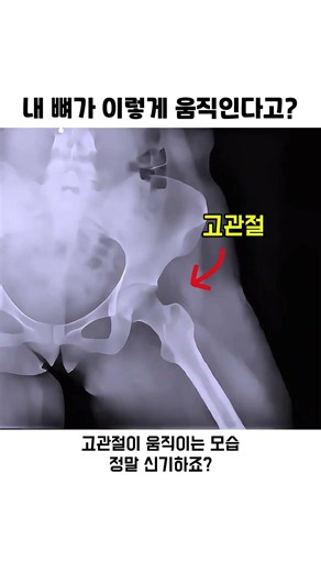 내 뼈가 이렇게 움직인다고? #고관절 #어깨관절 #엑스레이 #신체과학 #해부학