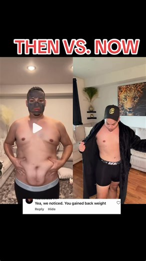 Bernardo Macias Jr on Instagram: "People love to hate, just because they ain’t happy lmao my butt gained it all 🤣 #tummytuck #bbl #plasticsurgery #surgery #fyp"