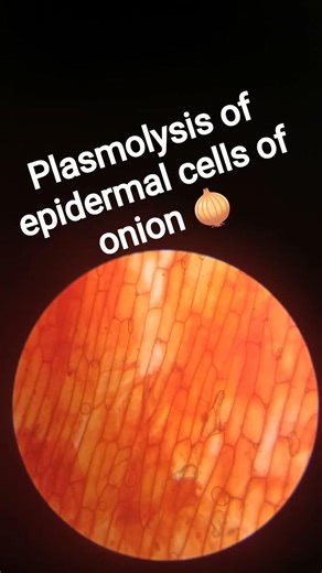 plasmolysis of epidermal cells of onion 🧅 class 11 practical under electron microscope 🔬