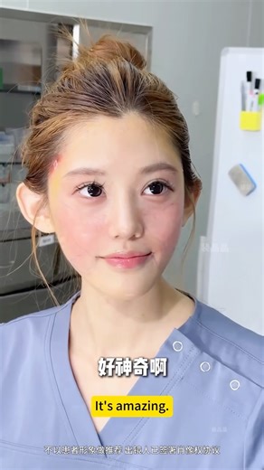Xiao Zhong Ye on Instagram: "💍 Bride-to-Be Glow Up 💍 With her big day just around the corner, this beautiful bride-to-be wanted to look her absolute best. Years of stress left her face sagging and tired — but with a 9D Facelift, everything changed. ✨ In just 40 minutes, her face was lifted, refined, and glowing with youthful energy. Now, she’s ready to walk down the aisle with confidence and radiance. 🌸 #9DFacelift #BridalGlow #WeddingReady #FacialLift #TimelessBeauty #GlowUp #YouthfulFace #N