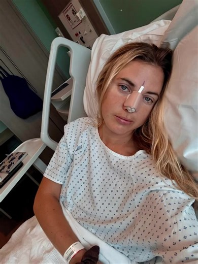 Nose Fix Complete: No More Breaks!