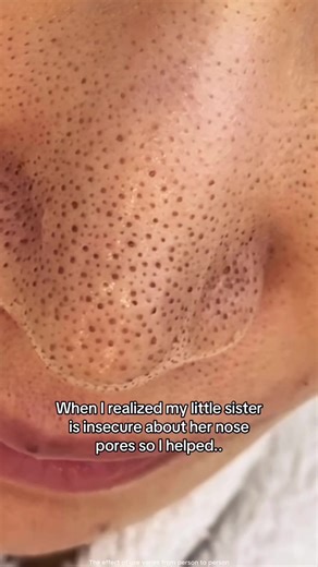 Effective Nasal Mask for Clean Pores Review