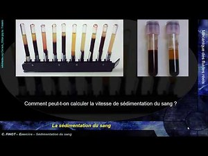 MK Flu 4 - 1.C3 - Vitesse de sédimentation du sang