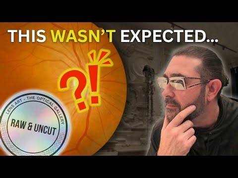 This Wasn’t Expected… What We Found During an Eye Scan