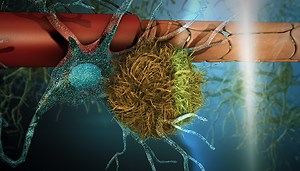 Treatments for dementia