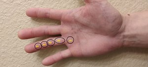 Rehabbing injured pulleys - My experience with rehabbing two A2 pulley issues - Steven Low