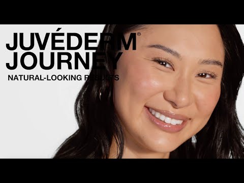 See why Sara loves her smooth, natural-looking results after getting treated with JUVÉDERM®.